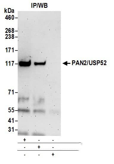 Immunoprecipitation USP52 Antibody