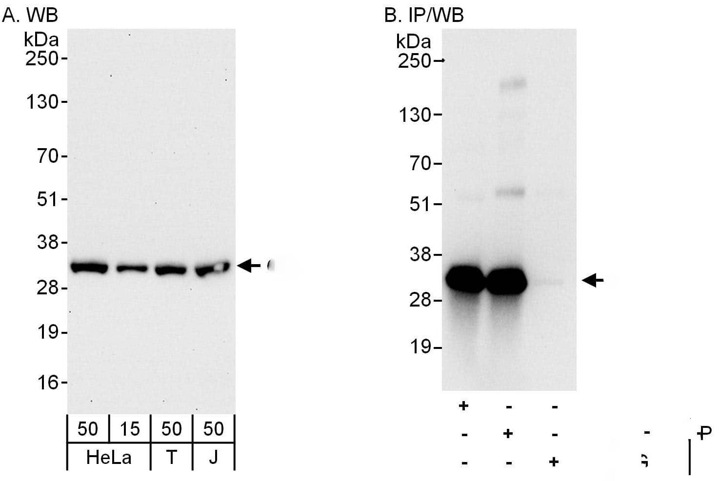 Western Blot:[NBP3-30714]-Detection of human CIP29 by western blot and immunoprecipitation. Samples: Whole cell lysate from HeLa , HEK293T and Jurkat cells. Antibodies: Affinity purified rabbit anti-CIP29 antibody used for WB at 0. 04 µg/ml and 0. 4 µg/ml and used for IP at 6 µg/mg lysate. CIP29 was also immunoprecipitated by rabbit anti-CIP29 antibody , which recognizes an upstream epitope. Detection: Chemiluminescence with exposure times of 30 seconds and 10 seconds.