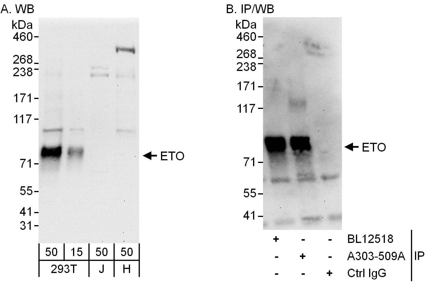 Western Blot:[NBP3-30717]-Detection of human ETO by western blot and immunoprecipitation. Samples: Whole cell lysate from HEK293T , Jurkat and HeLa cells. Antibodies: Affinity purified rabbit anti-ETO antibody used for WB at 0. 4 µg/ml and 1 µg/ml and used for IP at 6 µg/mg lysate. ETO was also immunoprecipitated by rabbit anti-ETO antibody , which recognizes an upstream epitope. Detection: Chemiluminescence with exposure times of 30 seconds.