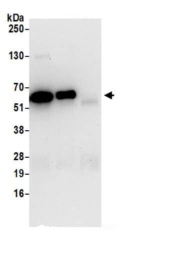 Immunoprecipitation:WDR1 AntibodyNBP3-30718] -Detection of human WDR1 by western blot of immunoprecipitates. Samples: Whole cell lysate (0.5 or 1.0 mg per IP reaction; 20% of IP loaded) from Jurkat cells prepared using NETN lysis buffer. Antibodies: Affinity purified rabbit anti-WDR1 antibody NBP3-30718 (lot NBP3-30718-1) used for IP at 6 µg per reaction. WDR1 was also immunoprecipitated by rabbit anti-WDR1.. For blotting immunoprecipitated WDR1, NBP3-30718 was used at 0.4 µg/ml. Detection: Chemiluminescence with an exposure time of 30 seconds.