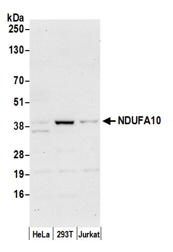 Western Blot:[NBP3-30721]-Detection of human NDUFA10 by western blot. Samples: Whole cell lysate from HeLa, HEK293T, and Jurkat cells prepared using NETN lysis buffer. Antibody: Affinity purified rabbit anti-NDUFA10 antibody used for WB at 0. 4 µg/ml. Detection: Chemiluminescence with an exposure time of 30 seconds.
