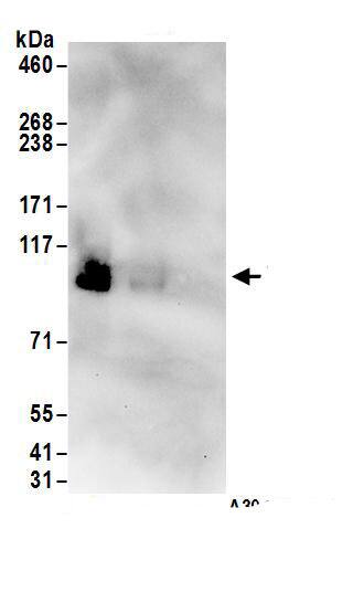 Immunoprecipitation:CINAP AntibodyNBP3-30723] -Detection of human DENTT by western blot of immunoprecipitates. Samples: Whole cell lysate (1 mg for IP; 20% of IP loaded) from HeLa cells. Antibodies: Affinity purified rabbit anti-DENTT antibody NBP3-30723 (lot NBP3-30723-1) used for IP at 6 µg/mg lysate. DENTT was inefficiently immunoprecipitated by rabbit anti-DENTT.. For blotting immunoprecipitated DENTT, NBP3-30723 was used at 1 µg/ml. Detection: Chemiluminescence with an exposure time of 30 seconds.