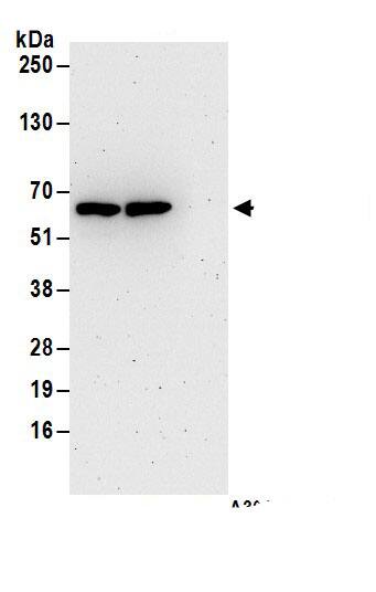 Immunoprecipitation:DYNC1LI1 AntibodyNBP3-30724] -Detection of human DYNC1LI1 by western blot of immunoprecipitates. Samples: Whole cell lysate (1 mg for IP; 20% of IP loaded) from 293T cells. Antibodies: Affinity purified rabbit anti-DYNC1LI1 antibody NBP3-30724 (lot NBP3-30724-1) used for IP at 6 µg/mg lysate. DYNC1LI1 was also immunoprecipitated by rabbit anti-DYNC1LI1.. For blotting immunoprecipitated DYNC1LI1, NBP3-30724 was used at 0.1 µg/ml. Detection: Chemiluminescence with an exposure time of 3 minutes.