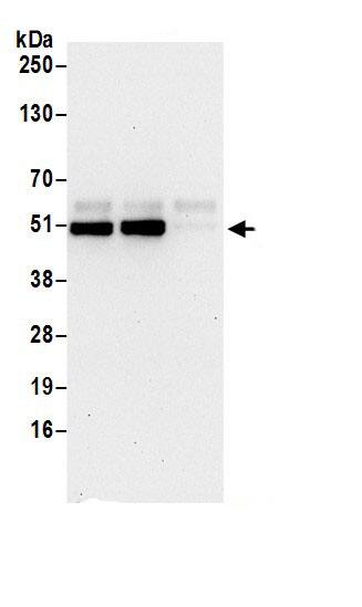 Immunoprecipitation:HS1BP3 AntibodyNBP3-30730] -Detection of human HS1BP3 by western blot of immunoprecipitates. Samples: Whole cell lysate (0.5 or 1.0 mg per IP reaction; 20% of IP loaded) from HeLa cells prepared using NETN lysis buffer. Antibodies: Affinity purified rabbit anti-HS1BP3 antibody NBP3-30730 (lot NBP3-30730-1) used for IP at 6 µg per reaction. HS1BP3 was also immunoprecipitated by rabbit anti-HS1BP3 antibody . For blotting immunoprecipitated HS1BP3, NBP3-30730 was used at 0.4 µg/ml. Detection: Chemiluminescence with an exposure time of 30 seconds.