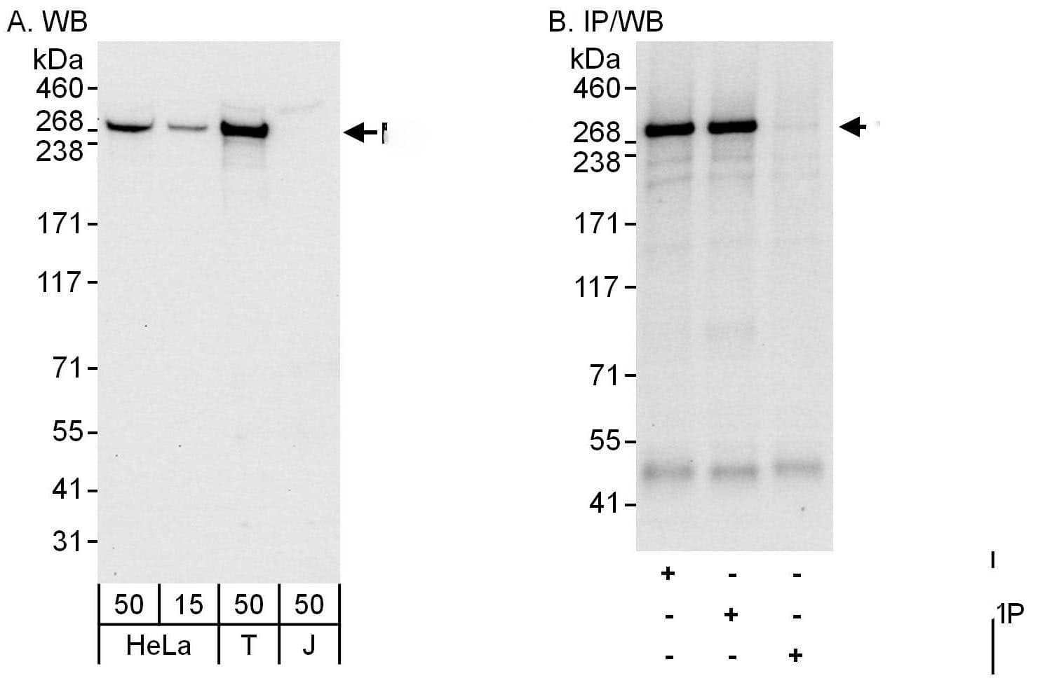 Western Blot:[NBP3-30731]-Detection of human Desmoplakin by western blot and immunoprecipitation. Samples: Whole cell lysate from HeLa , HEK293T , and Jurkat cells. Antibodies: Affinity purified rabbit anti-Desmoplakin antibody used for WB at 0. 1 µg/ml and 1 µg/ml and used for IP at 6 µg/mg lysate. Desmoplakin was also immunoprecipitated by rabbit anti-Desmoplakin antibody , which recognizes a downstream epitope. Detection: Chemiluminescence with exposure times of 10 seconds.