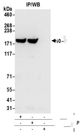 Immunoprecipitation:[NBP3-30732]-Detection of human CHC by western blot of immunoprecipitates. Samples: Whole cell lysate from 293T cells prepared using NETN lysis buffer. Antibodies: Affinity purified rabbit anti-CHC antibody used for IP at 6 µg per reaction. CHC was also immunoprecipitated by rabbit anti-CHC antibody. For blotting immunoprecipitated CHC, was used at 0. 4 µg/ml. Detection: Chemiluminescence with an exposure time of 3 seconds.