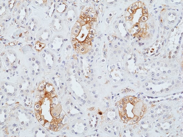 Immunohistochemistry-Paraffin Uroplakin II Antibody (RM507)