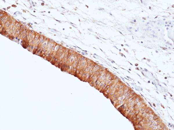 Immunohistochemistry-Paraffin: Uroplakin II Antibody (RM507) [NBP3-30733] - Immunohistochemical staining of formalin fixed and paraffin embedded human Ureter tissue sections using Clone RM507 at 1:200 dilution.