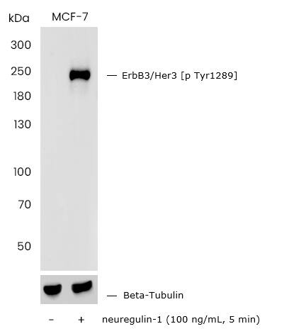 Western Blot: ErbB3/Her3 [p Tyr1289] Antibody (0004) [NBP3-30737] - Western blot analysis of extracts from serum-starved MCF-7, untreated (-) or treated with neuregulin-1 (100 ng/mL, 5 min) using (Cat# NBP3-30737) at 1:2000 dilution (upper), or Rabbit Polyclonal HER3/ERBB3 Antibody at 1:2000 dilution (middle), or Mouse Monoclonal Beta-Tubulin Loading Control Antibody at 1:2000 dilution (lower)