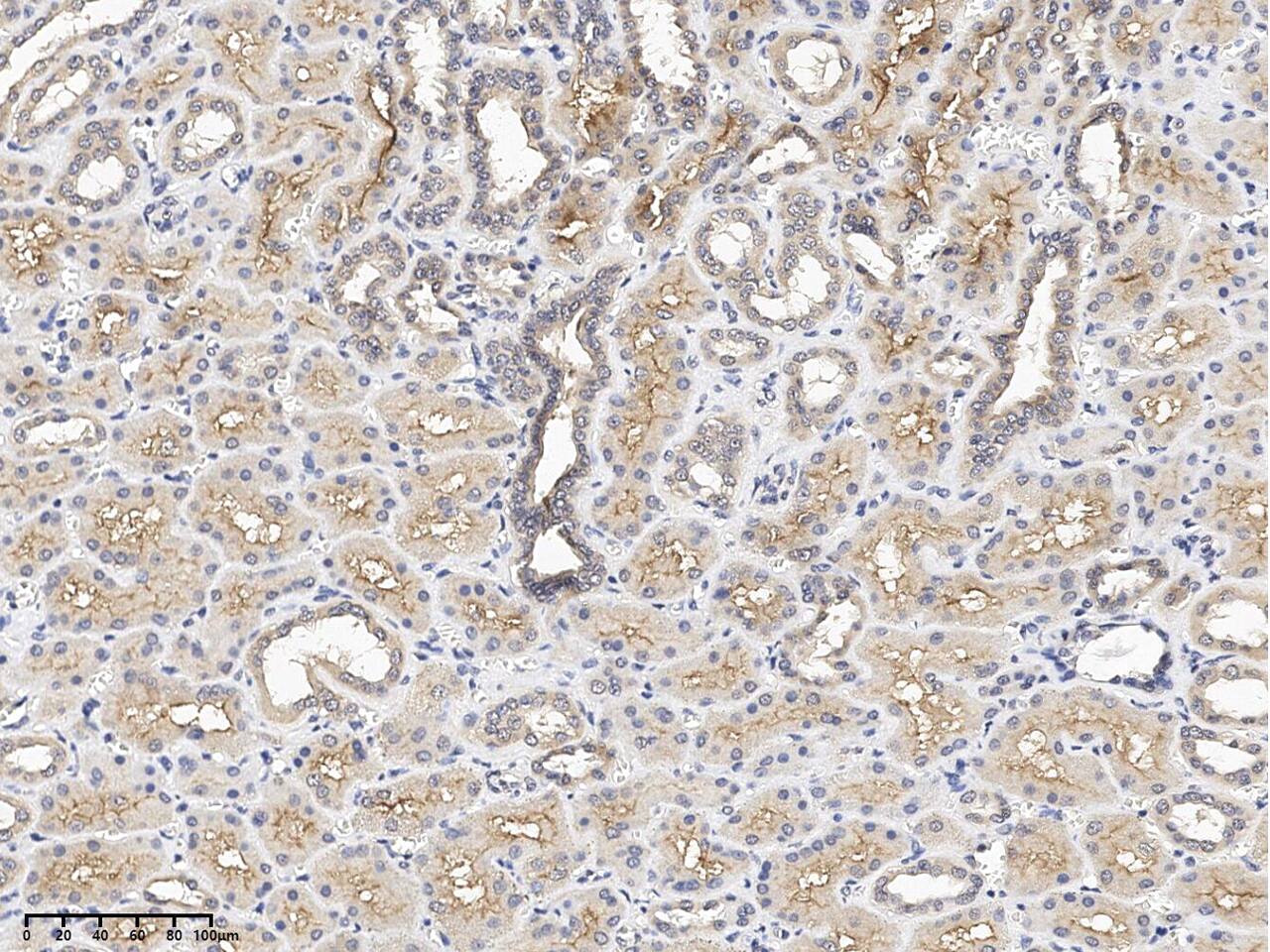 Immunohistochemistry-Paraffin dystrophia myotonica containing WD repeat motif Antibody - BSA Free