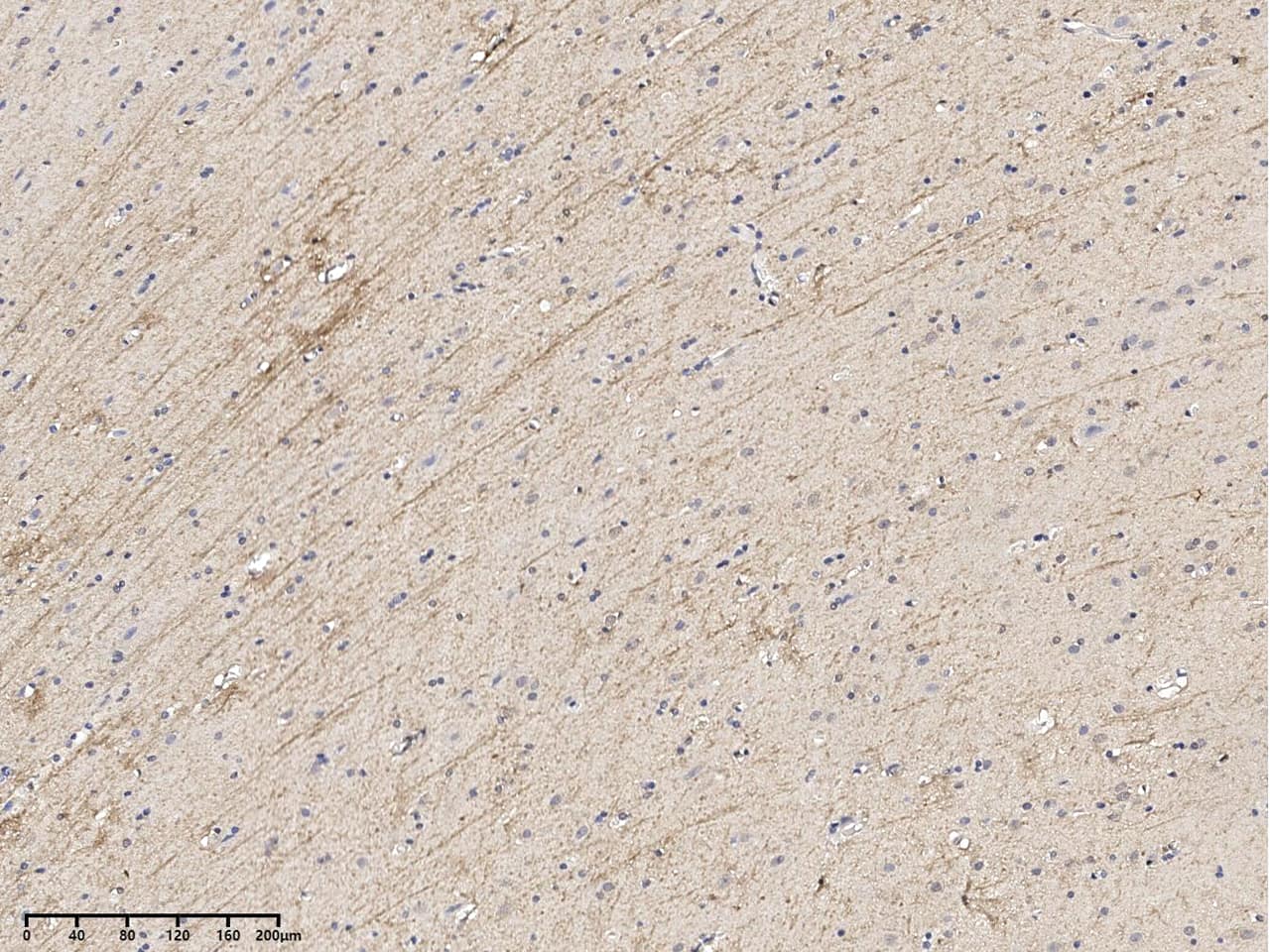Immunohistochemistry-Paraffin dystrophia myotonica containing WD repeat motif Antibody - BSA Free