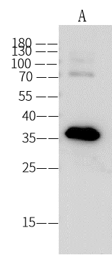 Western Blot: Dengue Virus NS5 Antibody (02) - (New Guinea C) [NBP3-30750] - NBP3-30750 at 1:1000 dilution. Lane A: Dengue virus DENV-2 (strain New Guinea C) NS5 (methyltransferase domain) / Nonstructural protein 5 Protein Secondary Goat Anti-Mouse IgG (H+L) [HRP] at 1/10000 dilution Developed using the ECL technique. Performed under reducing conditions. 
