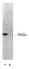 Western Blot: PPP2R5A Antibody [NBP3-30773] -  Legend: Novus Biologicals' rabbit anti PP 2 A/B alpha western blot of total rat brain homogenate.(+) indicates presence of specific blocking peptide of control peptide (-).