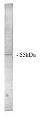 Western Blot: PPP2R5A Antibody [NBP3-30774] -  Legend: Novus Biologicals' sheep anti PP 2 A/B alpha western blot of total rat brain homogenate.
