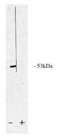 Western Blot: PPP2R5A Antibody [NBP3-30775] -  Legend: Novus Biologicals' rabbit anti PP2 A/B western blot of total rat brain extract.(+) or (-) indicates present of blocking peptide or control peptide.