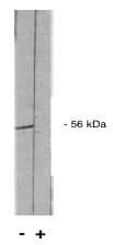 Western Blot: PP2A alpha/beta Antibody [NBP3-30777] -  Legend: Novus Biologicals PP 2 A/B’ pan 2 antibody western blot of total rat brain extract.(+) indicates blocking specific peptide or (-) or control peptide added.