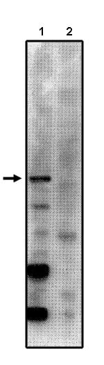Western Blot: PPP2R5C Antibody [NBP3-30779] -  Western blot analysis using anti-PP2A/B gamma 2 antibody on total rat brain homogenate with control peptide (1) and blocking peptide (2).