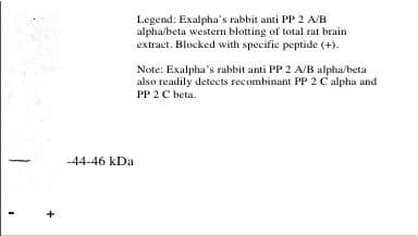 Western Blot: PP2C beta/PPM1B Antibody [NBP3-30782] -  Legend: Novus Biologicals' rabbit anti PP 2 A/B alpha/beta western blotting of total rat brain extract. Blocked with specific peptide (+). Note: Novus Biologicals' rabbit anti PP 2 A/B alpha/beta also readily detects recombinant PP 2 C alpha and PP 2 C beta.