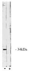 Western Blot: PP4/PPP4C Antibody [NBP3-30787] -  Legend: Novus Biologicals' sheep anti PP X/C interior antibody western blot of total bovine testes homogenate.(+) indicates presence of specific blocking peptide of control peptide (-).