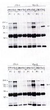 Western Blot: VAV2 Antibody [NBP3-30790] -  Legend:HEK293 cells were transfected with either emply expression vector (pSR alpha ) or pSRa-Vav2 driving expression of human Vav2. Indicated antibodies (SHD or DPH) were used to immunoprecipitate Vav2 from 300ug protein lysates. Immunoprecipitated activity was identified by immunoblot of complexes using either DPH (upper gel) or SHD (lower gel) antisera at (1:10000). Immunoprecipitation of Endogenous/Exogenous Vav2 from HEK 283 (75 ug lysate per lane). Top gel - i.p. Ab: DPH or SHD preimmune serum (2.5 µl/300 ug lysate). DPH or SHD alpha Vav2 antiserum (2.5 µl/300 ug lysate). Western Blot Ab: DPH anti Vav2 1:10000. Bottom Gel - i.p. Ab DPH or SHD preimmune sera (2.5 µl/300 ug lysate). DPH or SHD anti Vav2 antisera (2.5 µl/300 ̃ ug lysate). Western blot Ab - SHD anti Vav2 antibody 1:10000.