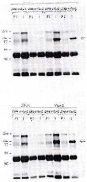 Western Blot: VAV2 Antibody (Polyclonal) [NBP3-30791] -  Legend: HEK293 cells were transfected with either emply expression vector (pSR␣ ) or pSRa-Vav2 driving expression of human Vav2. Indicated antibodies (SHD or DPH) were used to immunoprecipitate Vav2 from 300ug protein lysates. Immunoprecipitated activity was identified by immunoblot of complexes using either DPH (upper gel) or SHD (lower gel) antisera at (1:10000). Immunoprecipitation of Endogenous/Exogenous Vav2 from HEK 283 (75 ug lysate per lane). Top gel - i.p. Ab: DPH or SHD preimmune serum (2.5 ul/300ug lysate). DPH or SHD alpha Vav2 antiserum (2.5 ul/300ug lysate). Western Blot Ab: DPH anti Vav2 1:10000. Bottom Gel - i.p. Ab DPH or SHD preimmune sera (2.5 ul/300ug lysate). DPH or SHD anti Vav2 antisera (2.5ul/300ug lysate). Wrester blot Ab - SHD anti Vav2 antibody 1:10000.