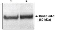 Western Blot: DAB1 Antibody - N-terminal [NBP3-30794] -  Western blot analysis using DAB1 (Cat. No. NBP3-30794) (1) and (CT) (2) on mouse brain extracts.