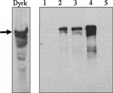 Immunoprecipitation: DYRK1A Antibody [NBP3-30799] -  Immunoprecipitation ofDyrk from 293T transfected cells. Immunoprecipitation with- 1) control Ab, 2)Anti-MNP 2 ug/ml, 3)Novus Biologicals' anti-Dyrk 2ug/ml, 4) Novus Biologicals'-Dyrk 10 ug/ml, 5)competitor’s anti-Dyrk Ab 10 ug/ml, Western blot performed with Novus Biologicals' anti-Dyrk Ab at 2 ug/ml.