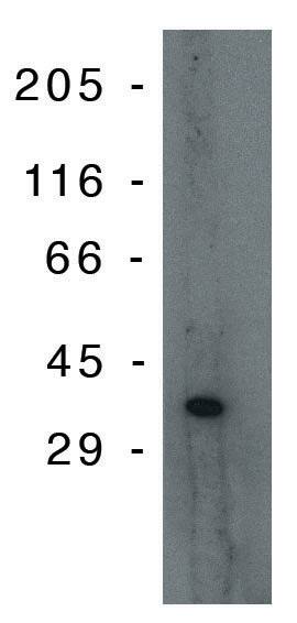 Western Blot: PIG3 Antibody (10A2) [NBP3-30804] -  Western blot analysis using PIG-3 monoclonal antibody on Jurkat lysate at 10 ug/ml on Jurka lysate.