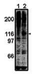 Immunoprecipitation: FAK Antibody [NBP3-30813] -  Immunoprecipitation off AK using FAK antibodypreimmune serum (1) and affinity-purified antibody (2).
