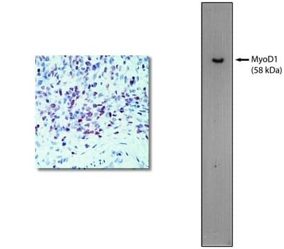 Western Blot: MyoD Antibody (5.2F) [NBP3-30815] -  Left: Immunohistochemical staining using MyoD antibody on formalin fixed, paraffin embedded human rhabdomyosarcoma. Right: Western blot using 60 ng of purified MyoD protein with MyoD antibody at 2 ug/ml and detected using goat anti-mouse HRP and visualized with Pierce West-Femto substrate.