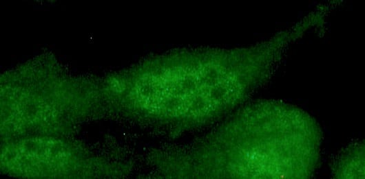 Immunocytochemistry/ Immunofluorescence: Myogenin Antibody (F12B) [NBP3-30816] -  Figure 2: Immunoreactivity of NBP3-30816, the mouse anti human myogenin in nuclei of formaldehyde fixed C2C12 mouse muscle myoblast cells in culture (high magnification).