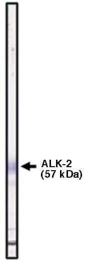 Western Blot: Activin RIA/ALK-2/Activin Receptor Type 1 Antibody [NBP3-30817] -  Western blot using ALK-2 antibody (cat. no. NBP3-30817) on ALK-2 fusion protein.