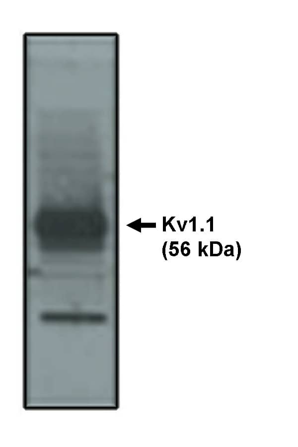 Western Blot: Kv1.1 Antibody [NBP3-30821] -  Western blot analysis using Kv1.1 antibody on rat brain lysate.