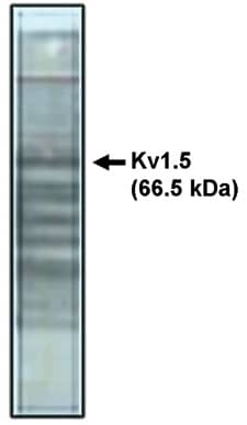 Western Blot: Kv1.5 Antibody [NBP3-30822] -  Western blot analysis using Kv1.5 antibody on rat brain lysate.