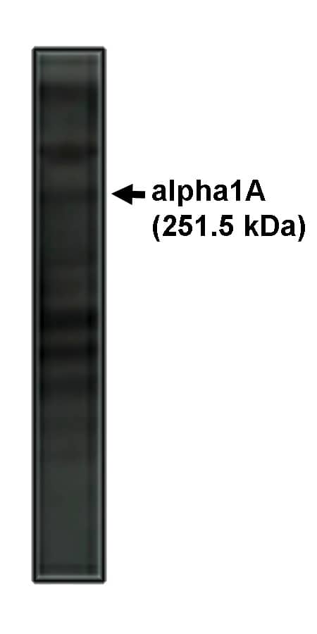 Western Blot: CACNA1A Antibody [NBP3-30826] -  Western blot analysis alpha 1A antibody on rat brain lysate.