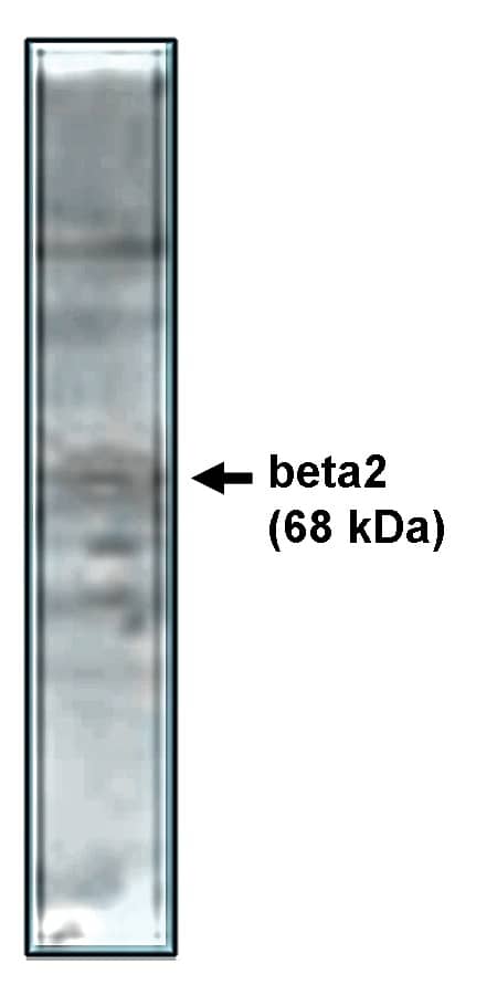 Western Blot: CACNB2 Antibody [NBP3-30831] -  Western blot analysis using beta2 antibody on rat brain lysate.