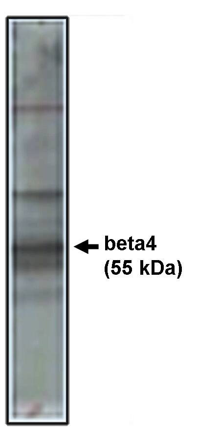 Western Blot: CACNB4 Antibody [NBP3-30833] -  Western blot analysis using beta4 antibody on rat brain lysate