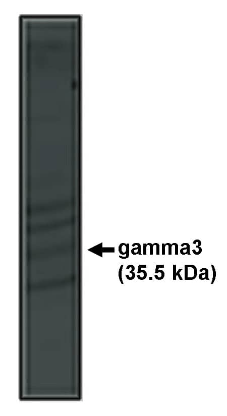 Western Blot: CACNG3 Antibody [NBP3-30834] -  Western blot analysis using gamma3 antibody on rat brain lysate
