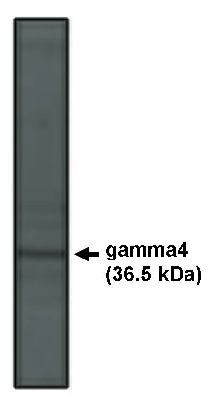 Western Blot: CACNG4 Antibody [NBP3-30835] -  Western blot analysis using  gamma 4 antibody on rat brain lysate at 5 ug/ml.