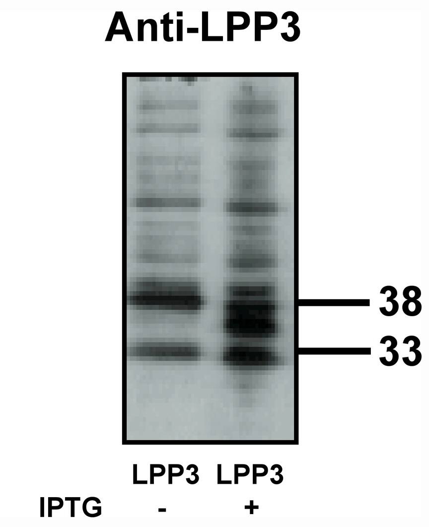 Western Blot: PPAP2B Antibody [NBP3-30837] -  Western blot analysis using LPP3 antibody on bacterially expressedLPP3 protein when untreated (-) and treated with with 0.1 mM IPTG(isopropyl-beta-D- thiogalactopyranoside) (+) at a dilution of 10 ug/ml.