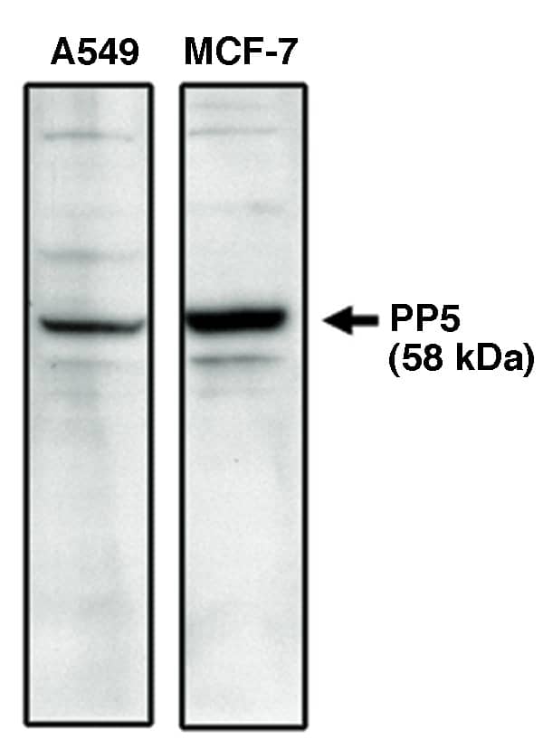 Western Blot: PP5 Antibody [NBP3-30838] -  Western blot analysis using PP5 specific antibody on A549 andMCF-7 cell lysates.