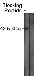 Western Blot: Sphingosine Kinase 1/SPHK1 Antibody [NBP3-30856] -  Western blot analysis using Sphingosine Kinase 1/SPHK1 antibody at a dilution of 1:400 on MDBK cell lysate using Novus Biologicals' mouse anti-rabbit HRP secondary antibody at 1:75,000.