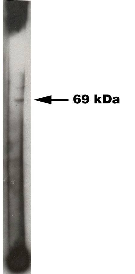 Western Blot: Sphingosine Kinase 2/SPHK2 Antibody [NBP3-30857] -  Western blot analysis using Sphingosine Kinase 2/SPHK2 antibody on 50 ng of recombinant Sphinogsine Kinase 2 enzyme. Antibody used at 1:200 dilution. Visualized using Pierce West Femto substrate system. Secondary used at 1:30k dilution. Exposure for 45 seconds.