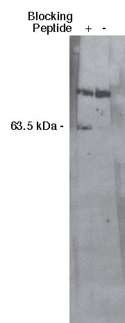 Western Blot: SGPL1 Antibody [NBP3-30858] -  Western blot analysis using S1P lyase 1 antibody at a dilution of 1:400 on MDBK cell lysate using Novus Biologicals' mouse anti-rabbit HRP secondary antibody at 1:75,000.