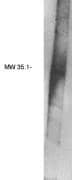 Western Blot: PPAP2B Antibody [NBP3-30861] -  Western blot analysis using PAP2B antibody on human brain lysate.