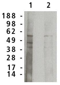 Western Blot: SMPD1 Antibody [NBP3-30865] -  Western blot analysis using acid sphingomyelinase antibody on normal human brain lysate (7 ug/lane). Antibody used at 1 ug/ml (1) and 0.5 ug/ml (2) and detected using mouse anti-rabbit antibody at 1:75k dilution and visualized using Pierce West Femto substrate.