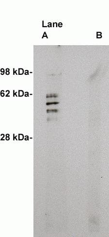 Western Blot: Sphingomyelin Synthase 2 Antibody [NBP3-30870] -  Western blot on human brain lysate (10 ug/lane) using Novus Biologicals' antibody to Sphingomyelin Synthase 2 (0.5 ug/ml). Lane A] 1 ug/ml antibody alone, lane B] antibody plus 3 ug blocking peptide. Blot was developed with Pierce’s Super System West Femto - 1 minute exposure.