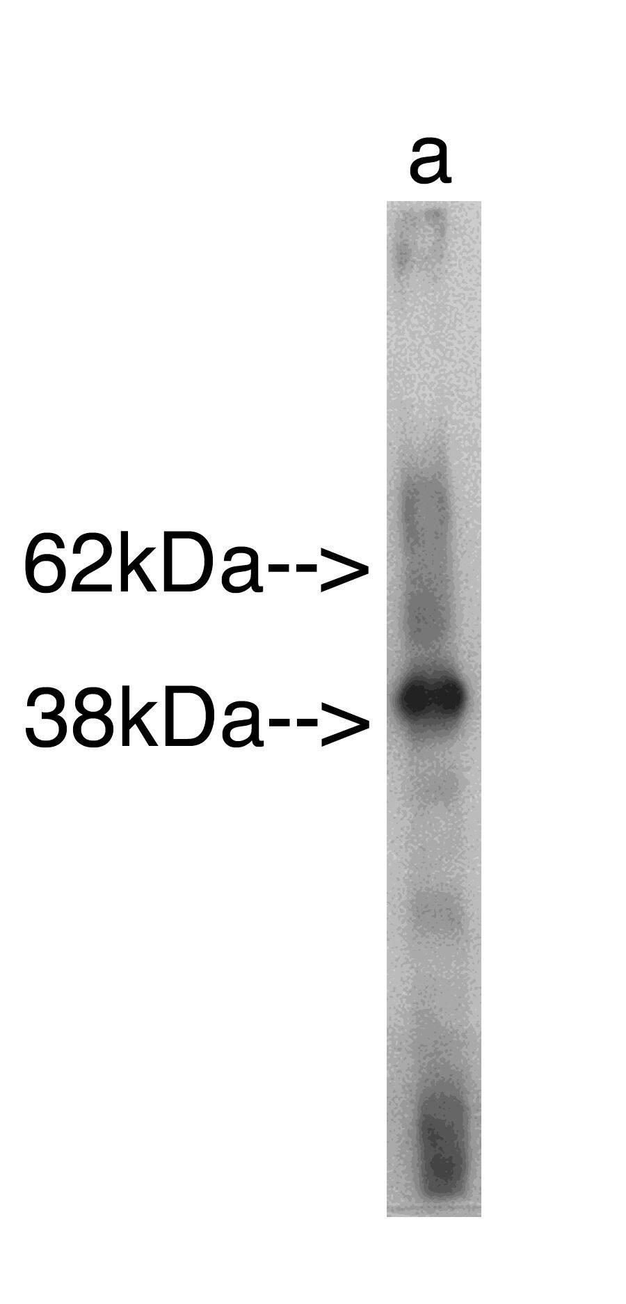 Western Blot: SAMD8 Antibody [NBP3-30871] -  Western blot analysis using Sphingomyelin Synthase r (Cat. # NBP3-30871) on recombinant protein Lane A] antibody alone. Anti Rabbit secondary used at 1:25K Exposure for 30 seconds