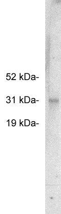 Western Blot: FHL2 Antibody [NBP3-30879] -  Western blot using Novus Biologicals' NBP3-30879, rabbit polyclonal at 0.5 ug/ml on HeLa cell extract (10 ug/lane). Blots were developed with goat anti-rabbit Ig (1:75k) and Pierce’s Supersignal West Femto system.