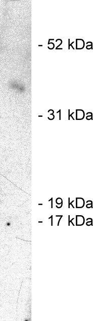 Western Blot: SIAH1 Antibody [NBP3-30880] -  Western blot using Novus Biologicals' NBP3-30880, rabbit polyclonal at 1 ug/ml on human brain lysate (20 ug/lane). Blots were developed with goat anti-MIg (1:30k) and Pierce’s Supersignal West Femto system.